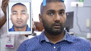 Nose Job Plastic Surgery Before & After Transformation | Dr. Sunil Richardson