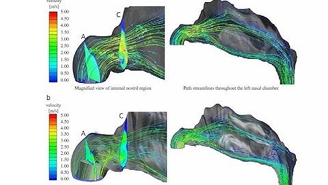 3.1 Drug delivery and particle deposition - Dr Kiao Inthavong