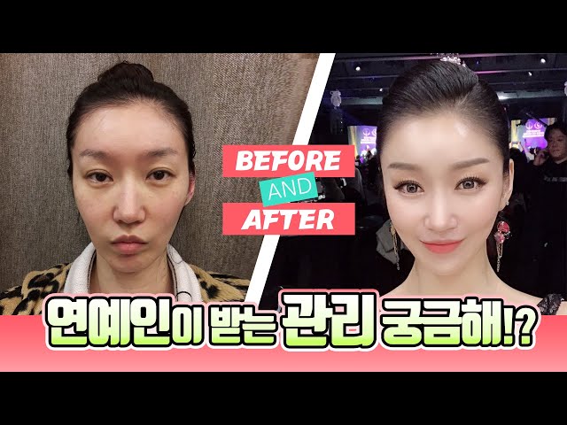 #임영민원장 카메라 앞에서도 당당하게! 연예인이 관리하는 방법! 리프팅, 지방이식, 쁘띠 수술전후 리얼스토리