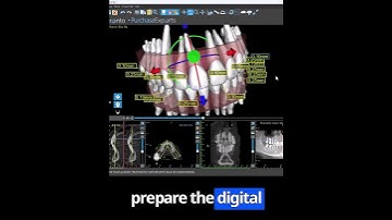 PART 3: Auto Teeth Setup #aligners #dentist #clearaligners