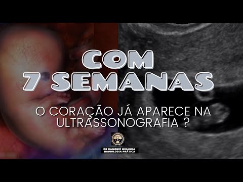 Vídeo: Como fazer um ultrassom para gravidez: 7 etapas (com fotos)