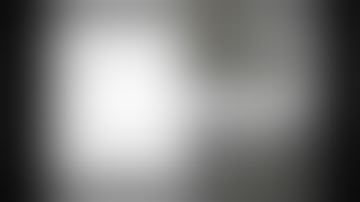 ERCP in Altered anatomy