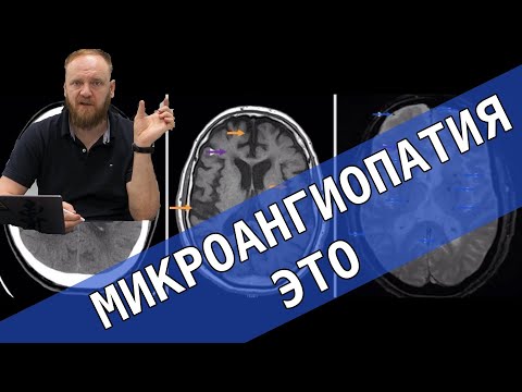 Видео: Что означает нейротрофический в медицинских терминах?