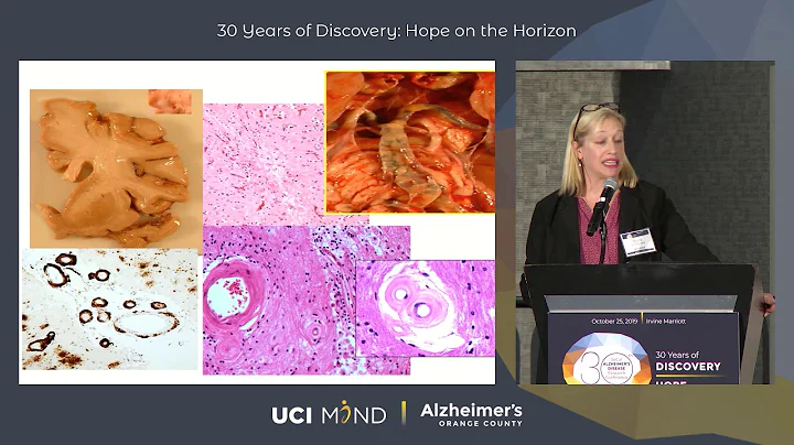 Julie Schneider, MD, MS - GIFTED BRAINS YIELD PRIC...