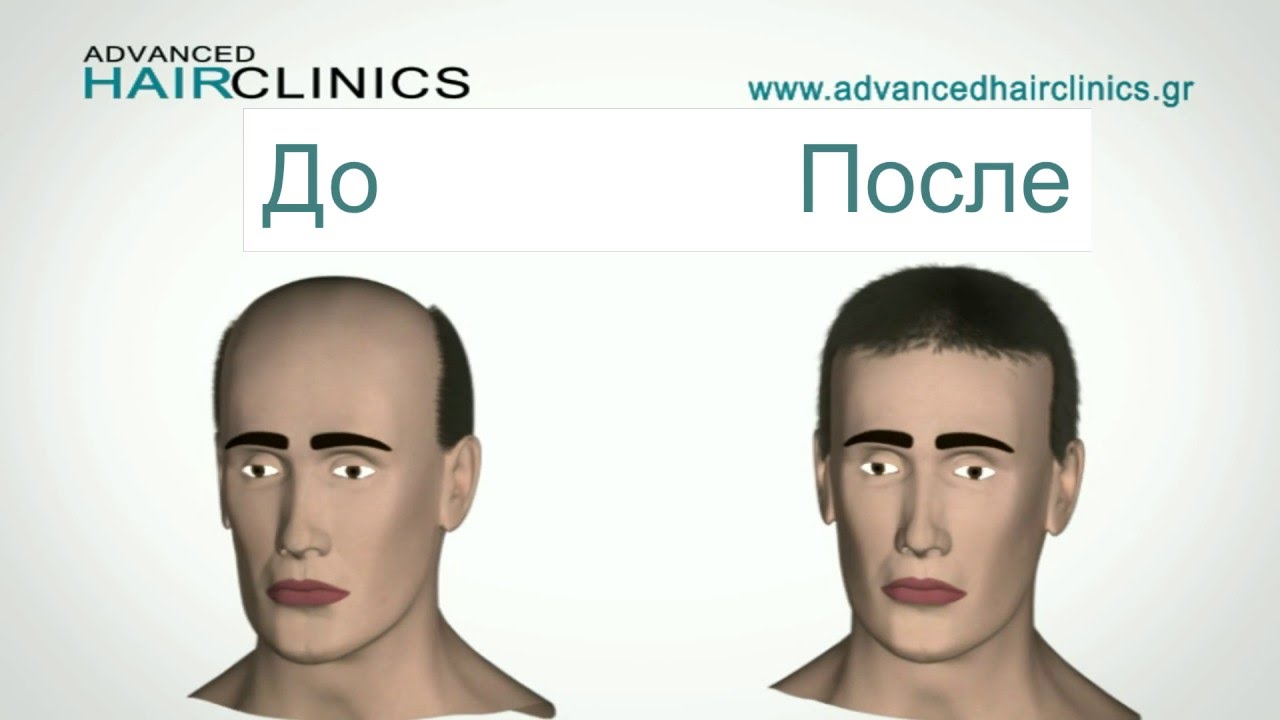 Средства для сухих и пушистых волос
