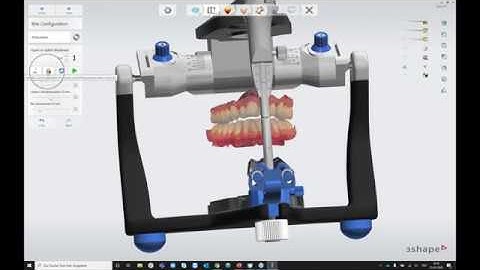 Webinar: 3Shape Splint Studio (German)