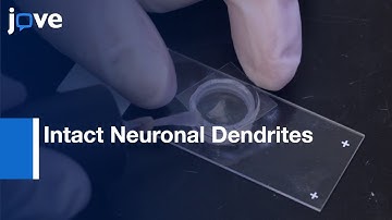 Intact Neuronal Dendrites quantification by CLARITY Tissue Clearing | Protocol Preview