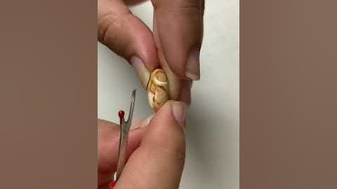 Dissection of kidney bean