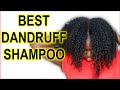 Best Dandruff Shampoo for Itchy Scalp, Psoriasis, Seborrheic dermatitis | Natural Hair