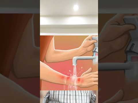 ٧ انواع من الجروح ممنوع تخيطها ولازم تسيبها مفتوحه دكتور طارق تركى