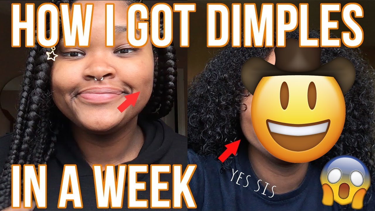 How I Got Dimples In A Week Youtube