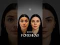 Botox Before & After: Can It Really Erase Forehead Wrinkles? | #EnfieldRoyalClinic #NewYork