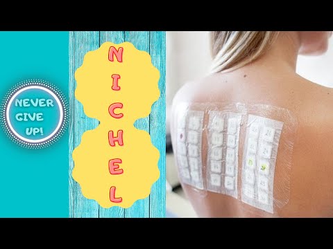 ALLERGIA AL NICHEL