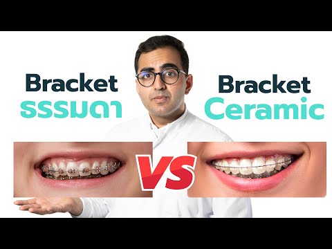 Bracket ธรรมดา vs. Bracket Ceramic‼️ I หมอฟัน SmileBox