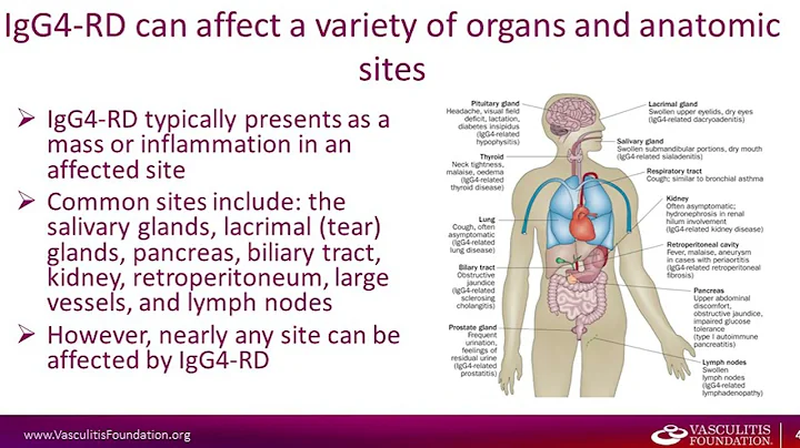 IgG4 Related Disease