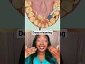 Teeth cleaning at a dental office #shorts #teethcleaning