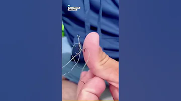 ماذا تفعل إذا دخلت صنارة صيد في يدك 