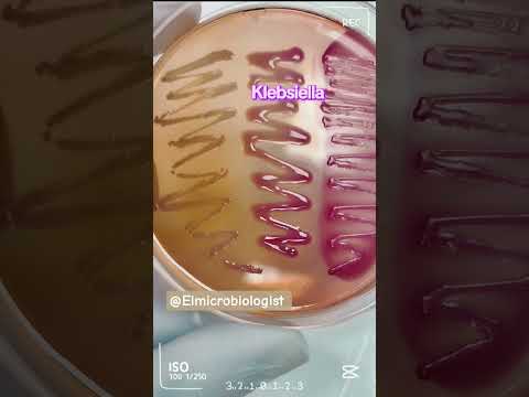 Escherchia Coli Klebsiella Pneumoniae Salmonella On MacConkey Agar Microbiology
