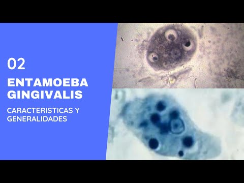 Entamoeba gingivalis 2.0 ||Parasitología  || Amebas || Amebiasis intestinal