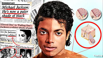 La evolución de la PIEL de Michael Jackson | (1958-2009) | The King Is Come