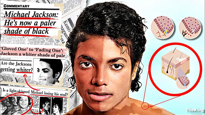 The evolution of Michael Jackson's SKIN | (1958-2009) | The King Is Come