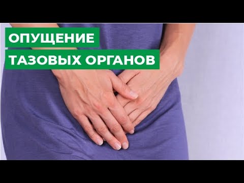 Опущение тазовых органов