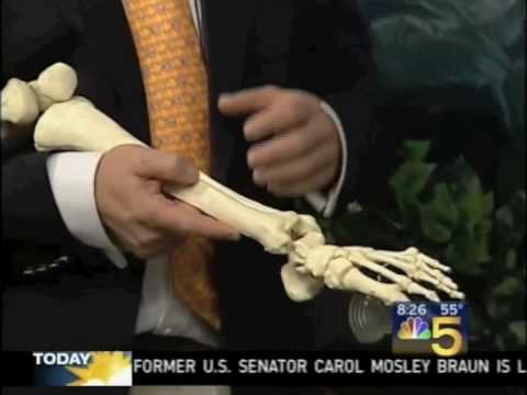 Dr. James Stoxen, DC Discusses Over Pronation of t...