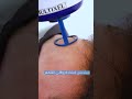 نصائح بعد جلسة الفراكشنال ليزر مع د أحمد عبدالفتاح أخصائي الجلدية والتناسلية والتجميل نصائح بعد جلسة الفراكشنال ليزر مع د أحمد عبدالفتاح أخصائي الجلدية والتناسلية والتجميل