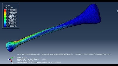 #abaqus tutorials : analysis of tibial bone