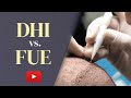 Dhi vs fue hair transplant which is the best choice in 2023