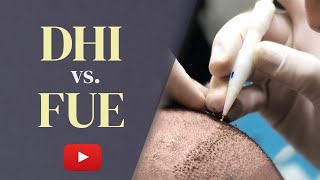 DHI vs FUE Hair Transplant: Which is the BEST Choice in 2023?