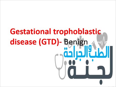 2.3.1 Bengin Gestational trophoblastic disease