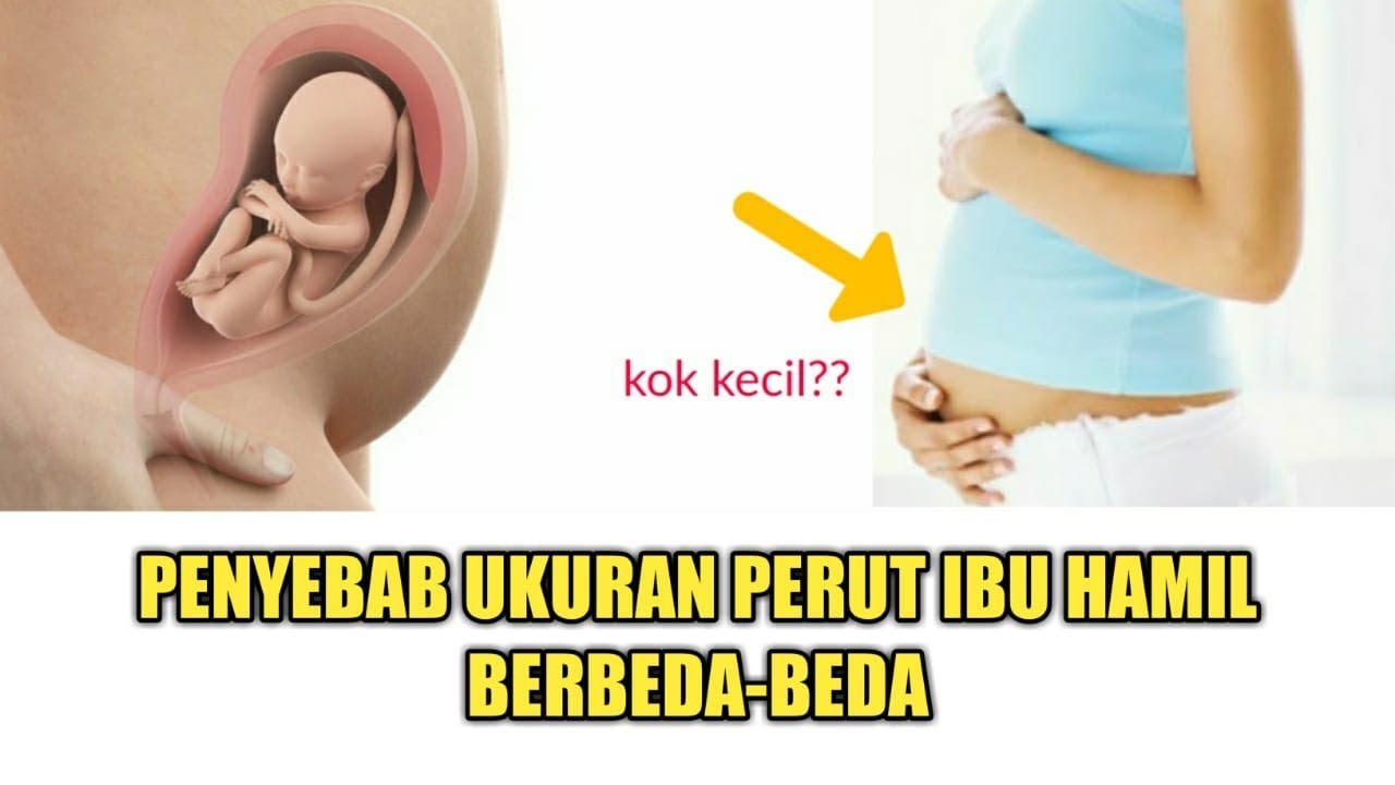 22 Obat Keputihan Untuk Ibu Hamil Akibat Jamur Hamil