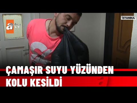 Hem kolundan oldu hem de işinden - atv Haber 22 Ekim 2021