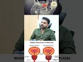 പ്രോസ്റ്റേറ്റ് ഗ്രന്ഥിയുടെ വീക്കവും സ്ക്രീനിംഗും - Dr. Jacob Thomas