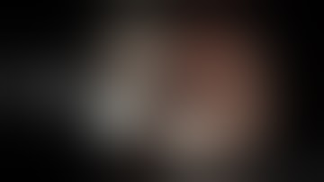 GIST Resection (EFTR) with the GERDX™-System (by G-SURG™ GmbH) Video © Doz. Georg Spaun