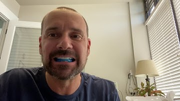 Sleep Apnea dental appliance by Somnomed