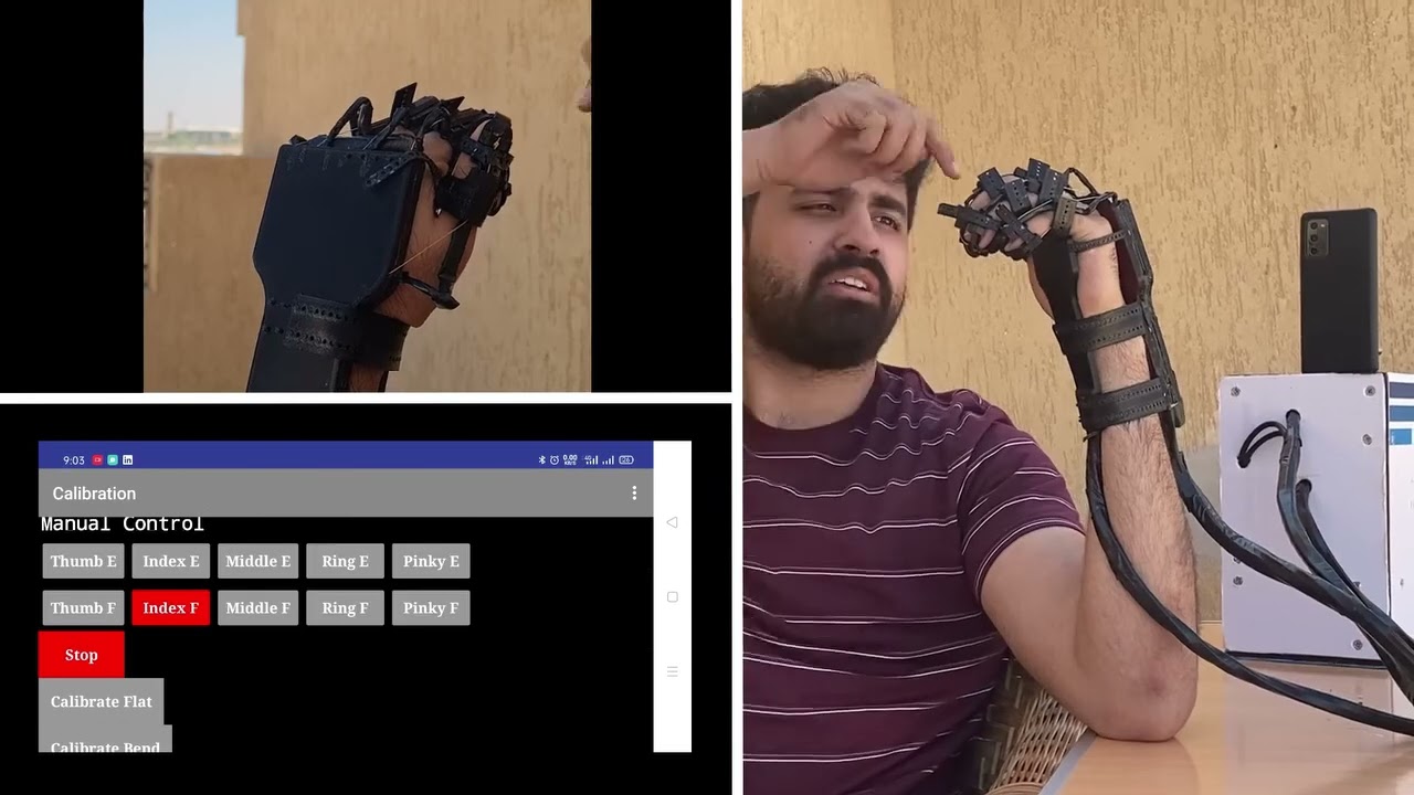 Rehabilitation Glove for Poststroke Patients