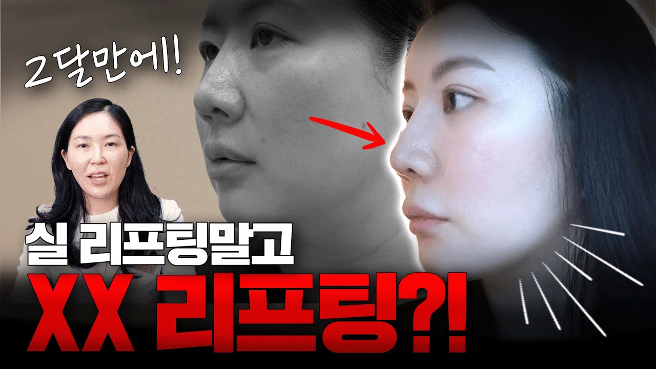 이 리프팅은 확실한 변화를 약속합니다...!😎