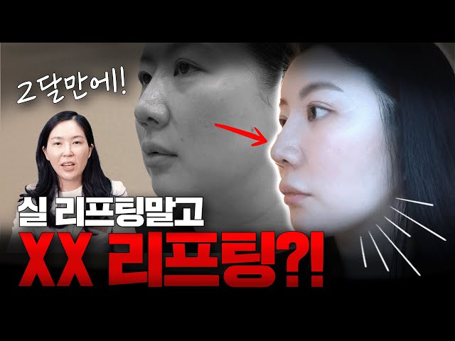이 리프팅은 확실한 변화를 약속합니다...!😎