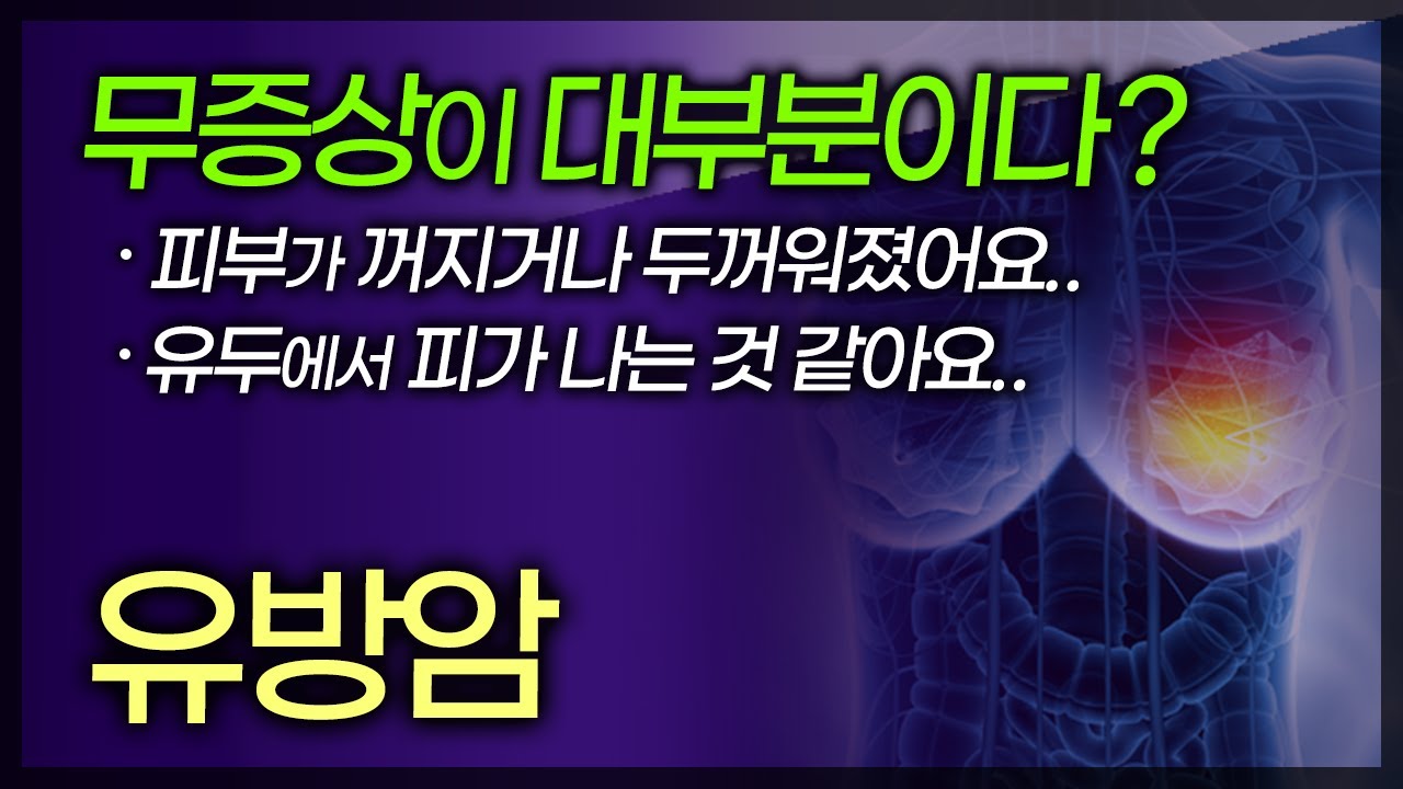 대부분 무증상의 경우가 많다는 유방암! 내 유방에 작은 변화가 생기더라도 그냥 지나치지 말고, 적극적으로 대처해야 한다 [ TV닥터인사이드 ] 20170326