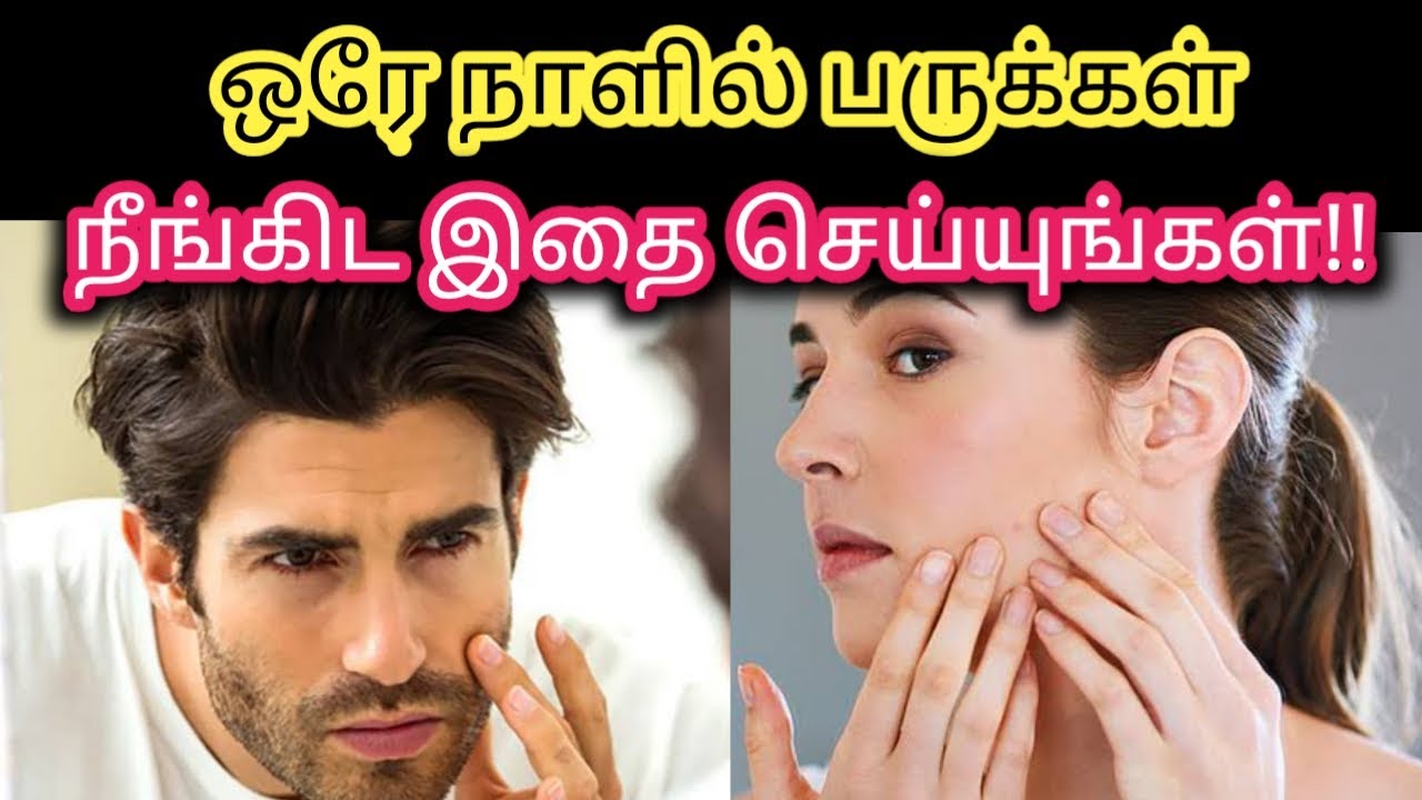 How to Remove Pimples Overnight Home Remedy for Pimples Pimples