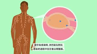 What is cancer? (Chinese Hong Kong) | 甚麼是癌症？繁體中文| Macmillan Cancer Support