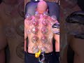 Fire cupping #firecupping #cupping #relax #bodypainrelief #massagetherapy #sportsmassage #gym #