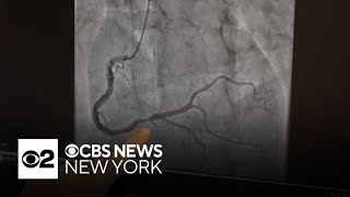 CBS cameraman discusses his genetic risk factor for heart disease