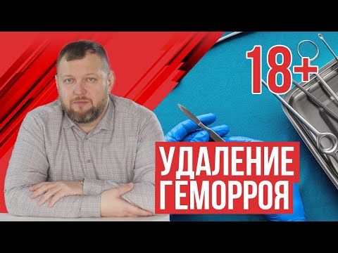 Удаление геморроя (видео операции)