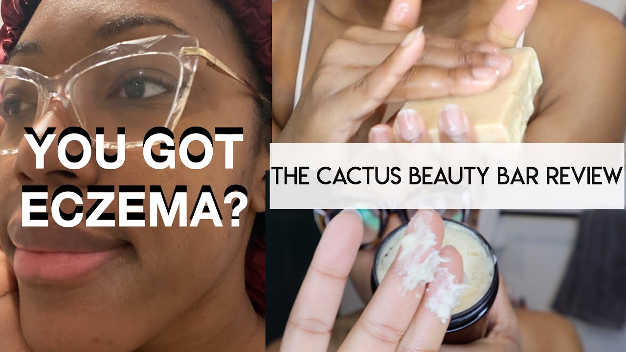 BEST BLACK OWNED SKINCARE BRAND FOR ECZEMA, ACNE, SENSITIVE SKIN