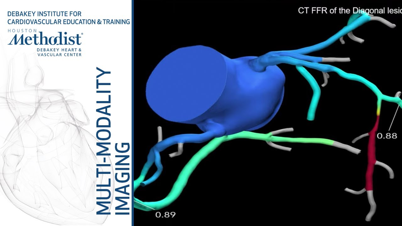 Multi-Modality Case Studies in Chest Pain Evaluation (Mouaz Al-Mallah, MD & CV Fellows) May 28, 2019 educational research and reviews