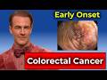 The Shocking Rise: Colorectal Cancer in Younger People
