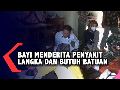 Video: Penyakit Yang Jarang Berlaku: Seorang Gadis Tanpa Hidung Dilahirkan Di Britain - Pandangan Alternatif